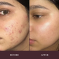 Revive N Renew Face Serum