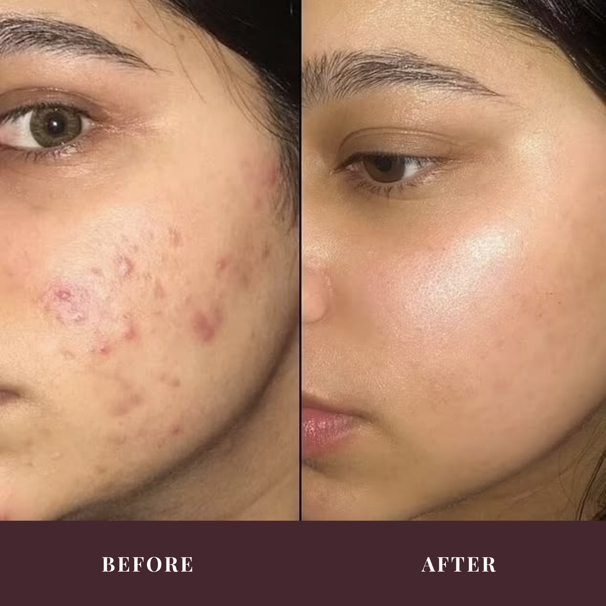 Revive N Renew Face Serum