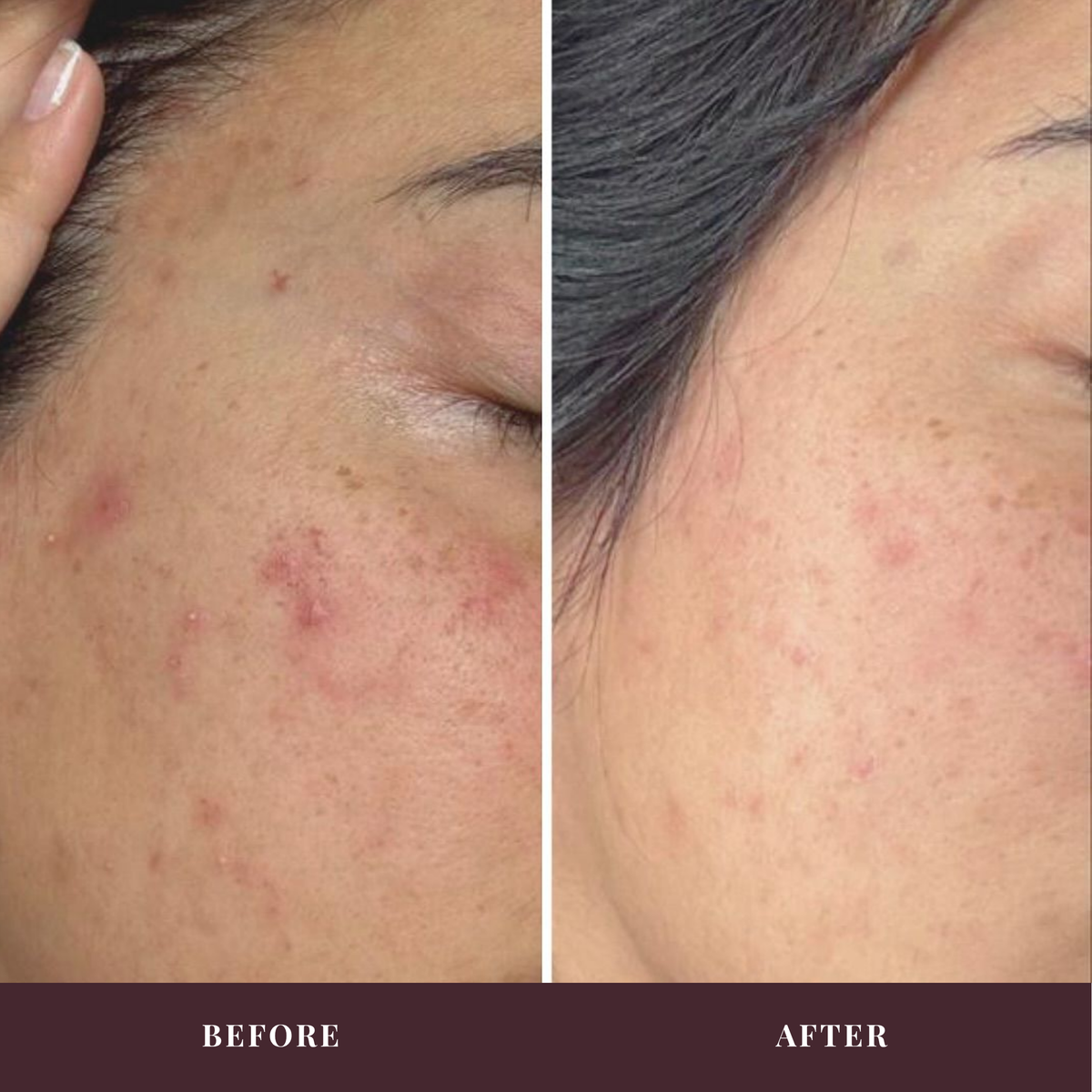 Skin Refine Face Cream