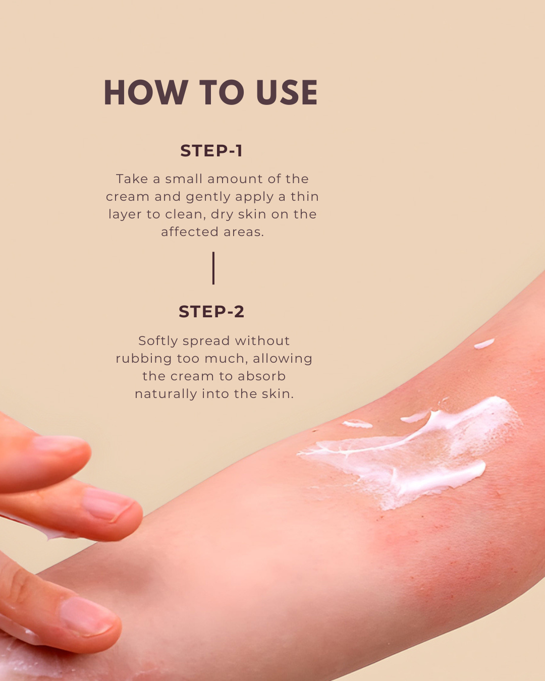 Eczema & Psoriasis Relief Cream